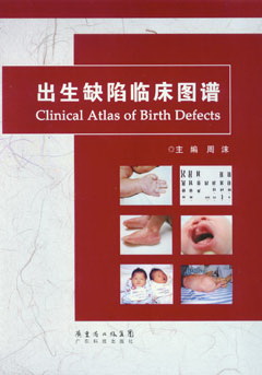 出生缺陷臨床圖譜