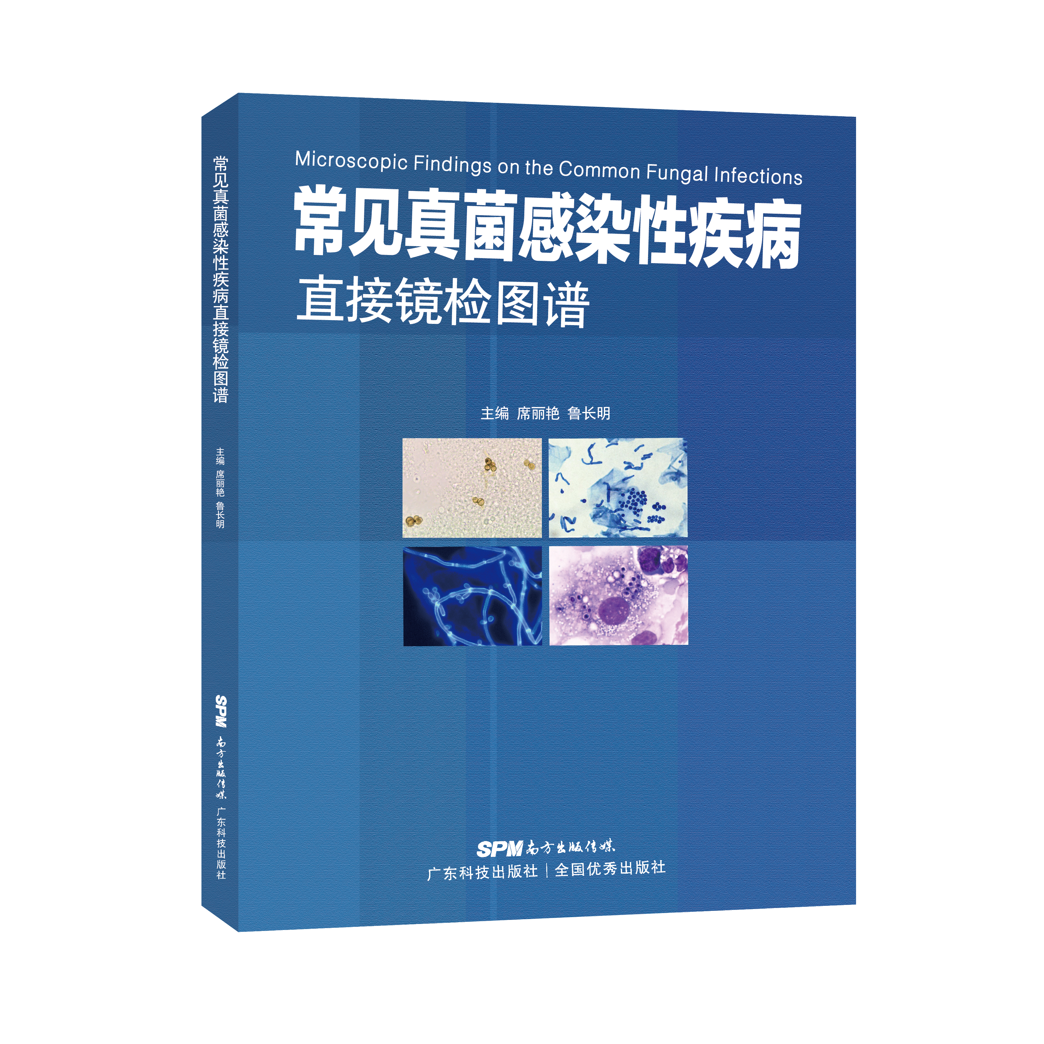 常見(jiàn)真菌感染性疾病直接鏡檢圖譜