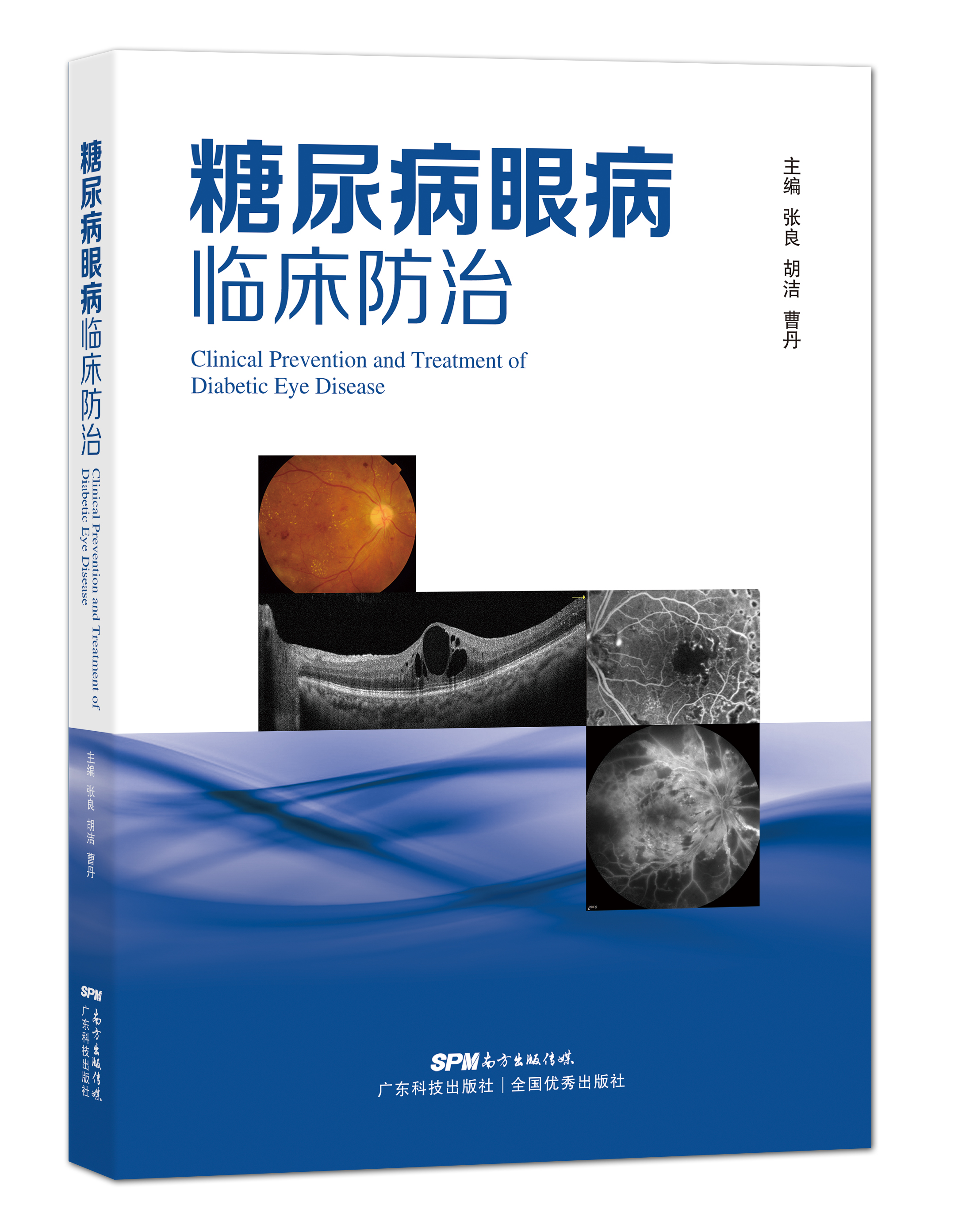 糖尿病眼病臨床防治